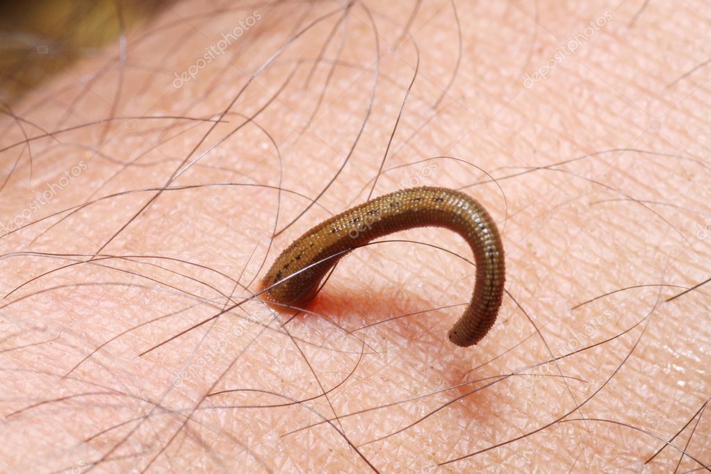 Leech On Skin