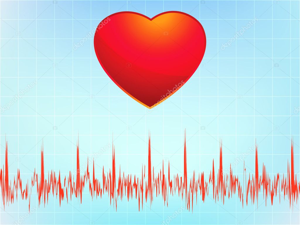 heart attack ecg. Heart attack electrocardiogram-ecg. EPS 8