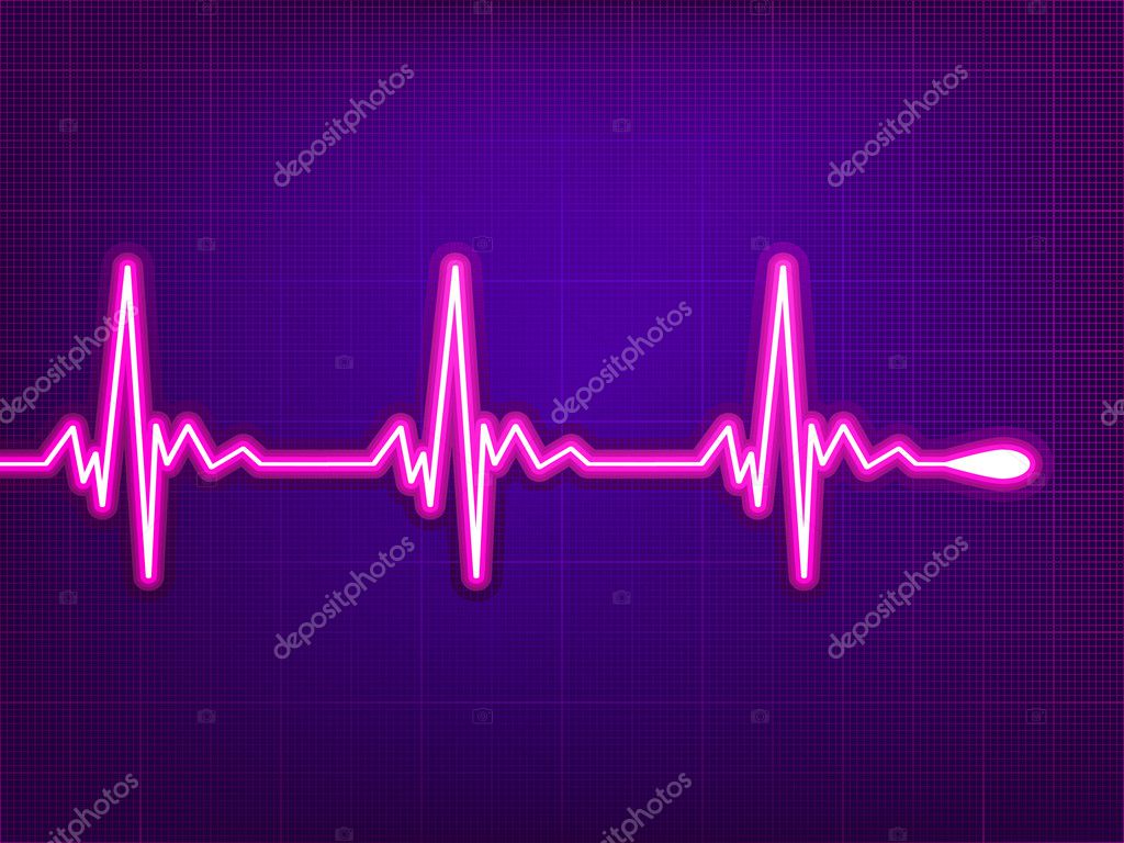 Cardiogram Picture