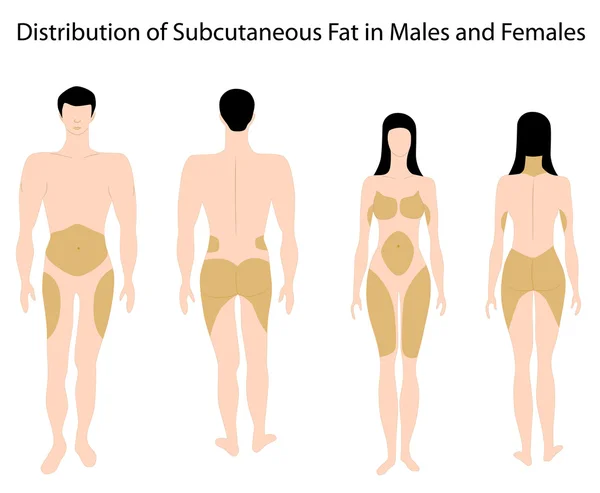 male fat distribution