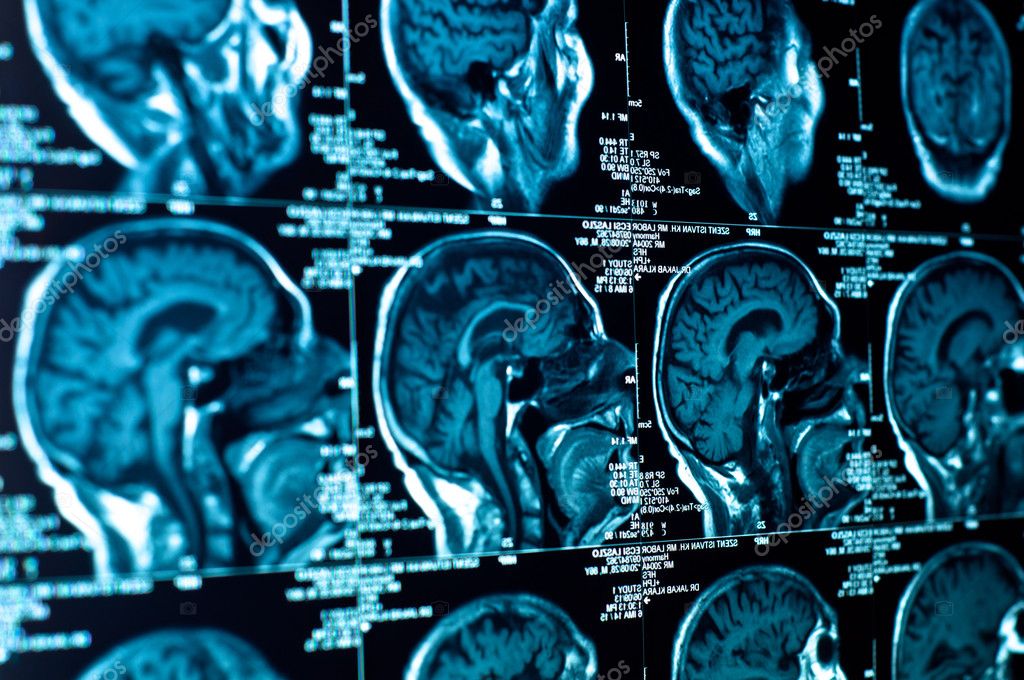 Ct+scan+of+brain+images