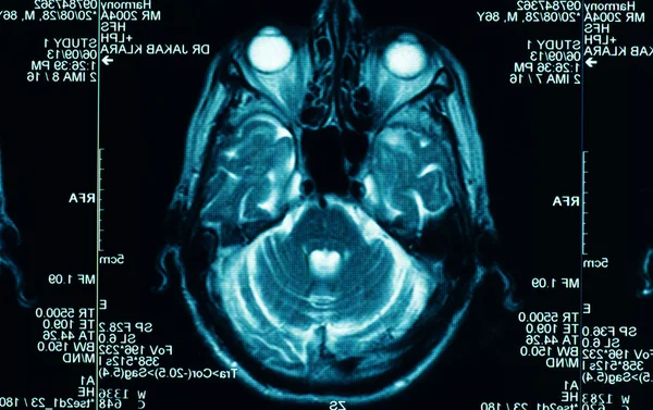 Sharp ct scan of the human brain