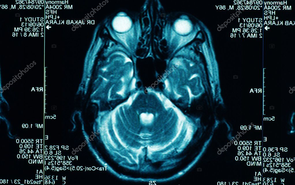 Ct+scan+of+brain+images