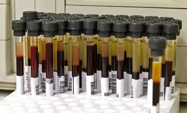 Blood samples tubes