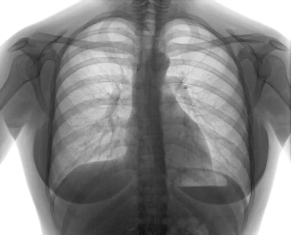 Promieniowania rentgenowskiego — Zdjęcie stockowe