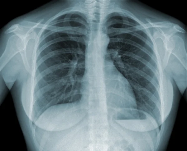 Рентгенограмма — стоковое фото