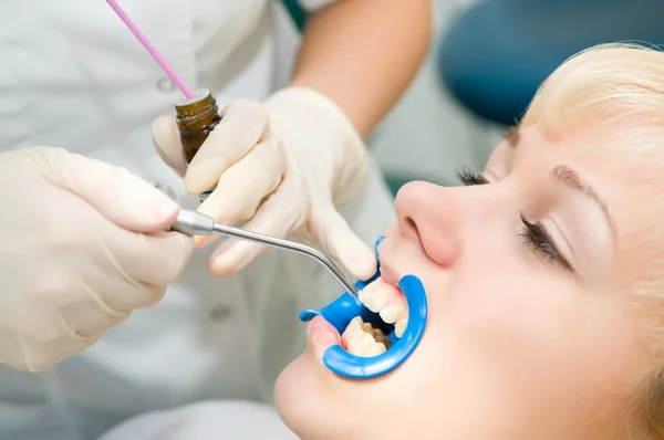 Dental teeth treatment — Stock Photo, Image