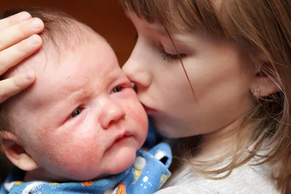 Sister kisses her brother — Stock Photo, Image