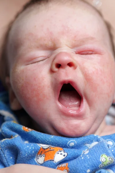 Bebé bocejo — Fotografia de Stock