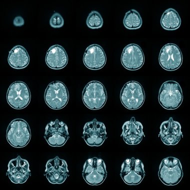 insan beyninin Mr manyetik risonance görüntü
