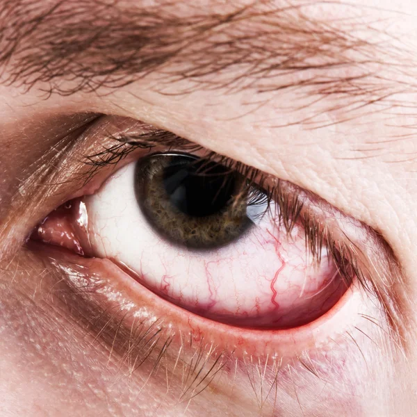 Occhio umano capillare del sangue — Foto Stock