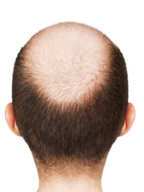 Bald men head clipart