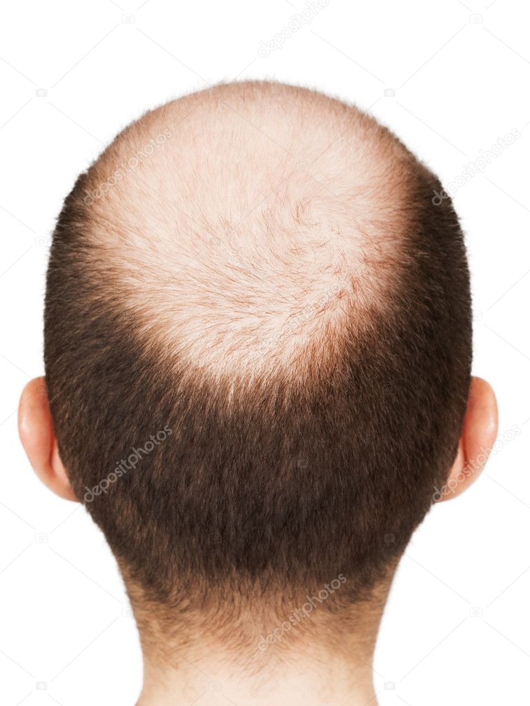 Bald men head Stock Photo by ©ia__64 6041505