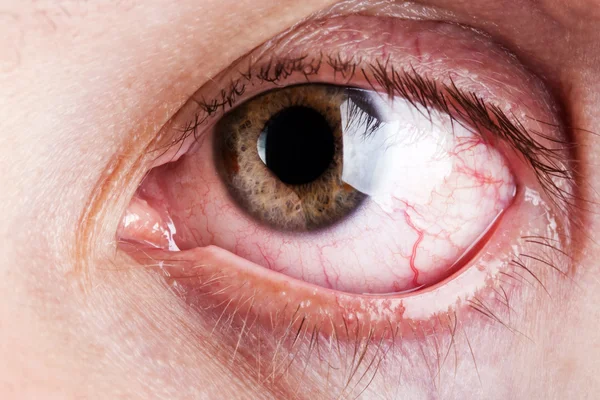Bloed capillaire menselijk oog — Stockfoto