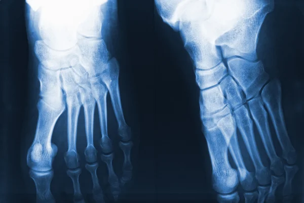 Ножной рентген — стоковое фото