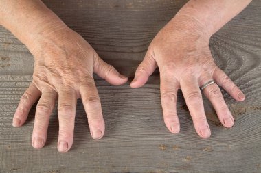 yaşlı kadının elleri