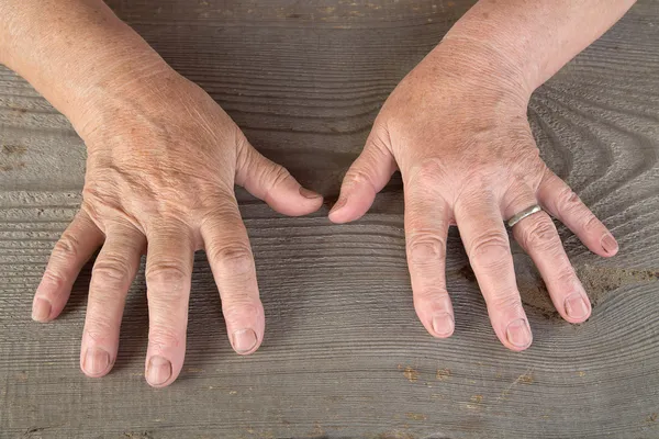 Руки старої жінки — стокове фото