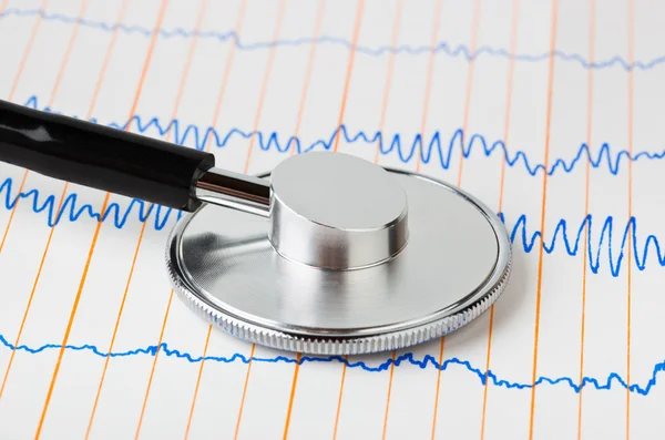 Stetoskop på EKG — Stockfoto