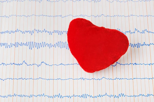 Leksak hjärtat på EKG — Stockfoto