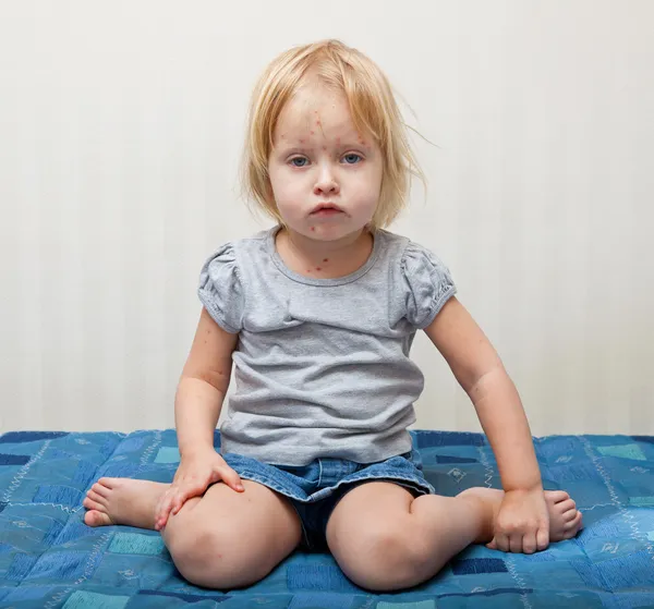 Chory dziewczynka siedzi koło łóżka — Zdjęcie stockowe