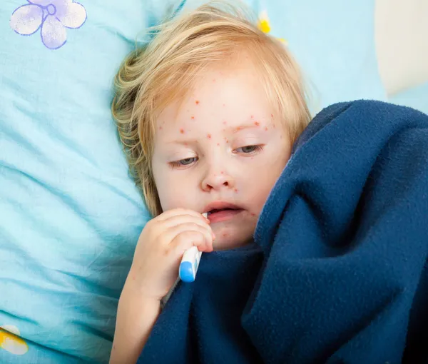 Uma rapariga doente mede a temperatura. — Fotografia de Stock