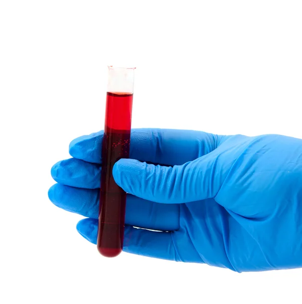 Injectieflacon van bloed in zijn hand — Stockfoto
