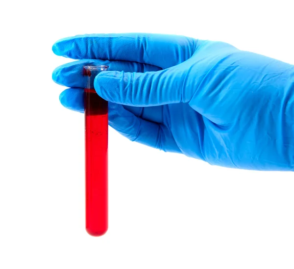 Injectieflacon van bloed in zijn hand — Stockfoto