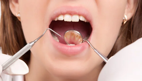Dental treatment at the dentist — Stock Photo, Image