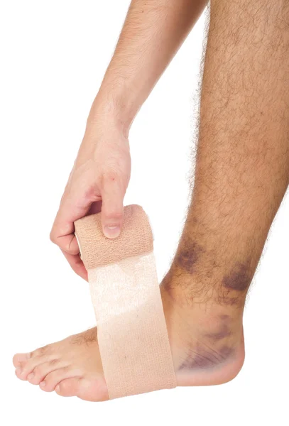 Bandaging a sprained ankle — Stock Photo, Image