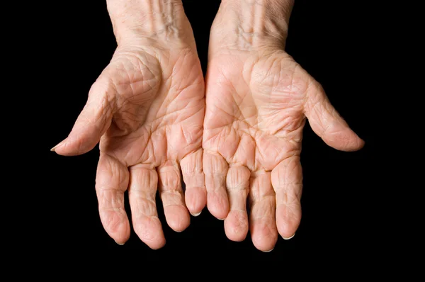 黒い背景の老婦人の手 — ストック写真