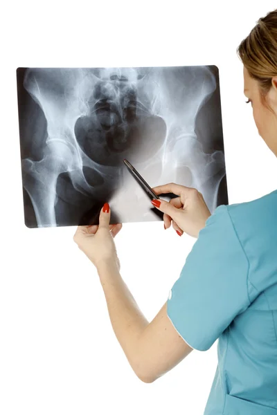 Kadın Doktor Röntgen resim incelenmesi. x-ışını im üzerinde odaklanmıştır — Stok fotoğraf