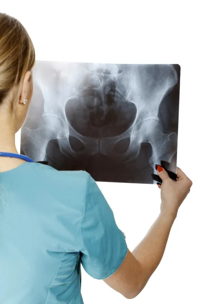 Female doctor examining an x-ray image. Focus is on the x-ray im Royalty Free Stock Photos