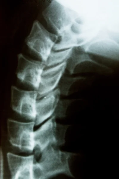 Neck X-ray