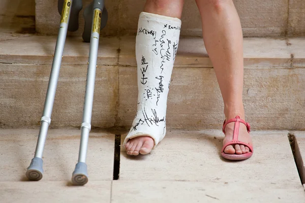 Femme avec jambe en plâtre — Photo