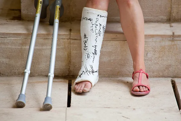 Frau mit Bein in Gips lizenzfreie Stockbilder