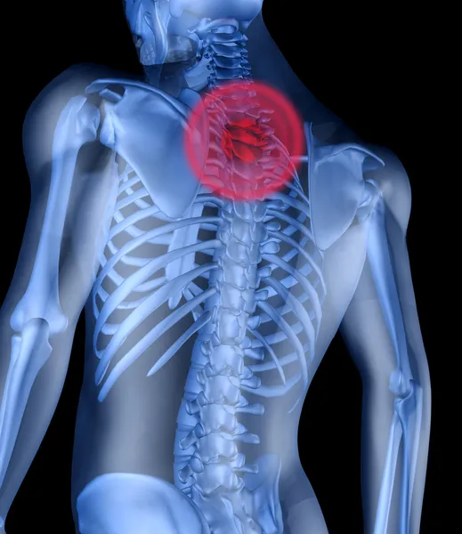 背骨の痛みのセンターと、人間の骨格 — ストック写真