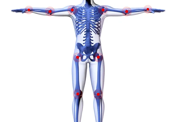 El esqueleto del hombre con los centros de los dolores de las articulaciones —  Fotos de Stock