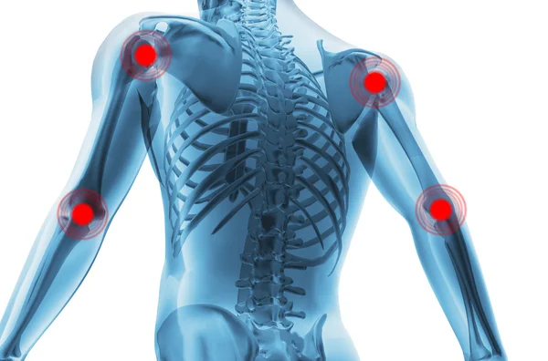 Скелет человека с центрами болей в суставах — стоковое фото