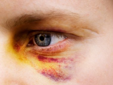 Black Eye Detail clipart