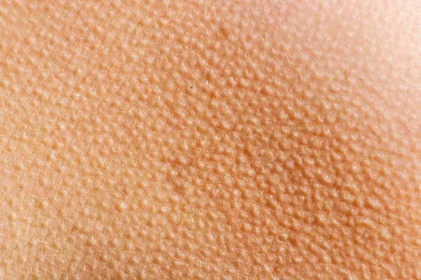 Goosebumps Fundo da pele — Fotografia de Stock