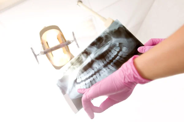 Detalhes do raio-X do dentista — Fotografia de Stock