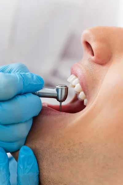 Dentista de broca — Fotografia de Stock