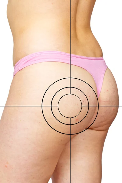 Cellulite und Target — Stockfoto
