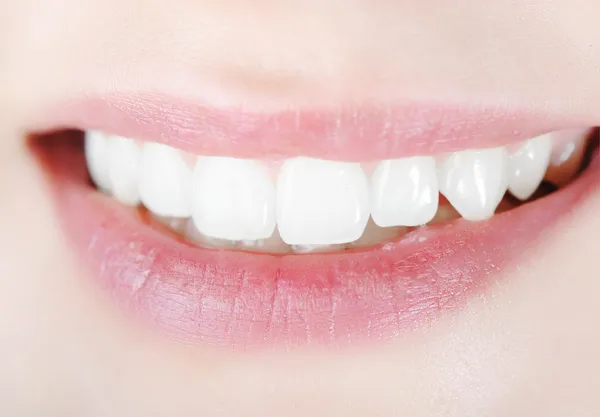 偉大な歯と笑顔の女性の口 — ストック写真