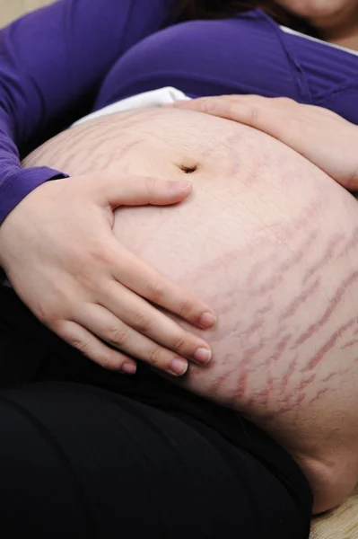 Huid zorg kwestie op buik van zwangere vrouw — Stockfoto