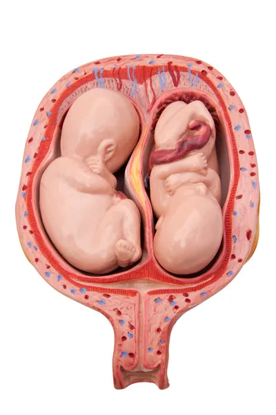 Twins in een baarmoeder — Stockfoto