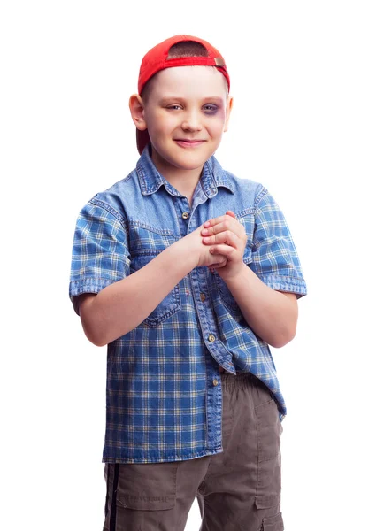 Boy with a bruise — Stock Photo, Image
