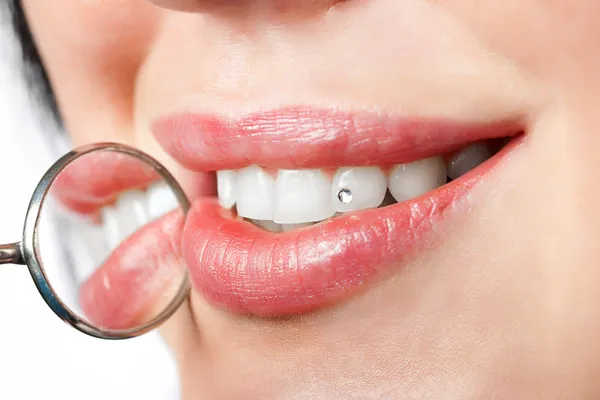 Espelho de boca dental perto de dentes brancos saudáveis da mulher com pedra preciosa em i — Fotografia de Stock