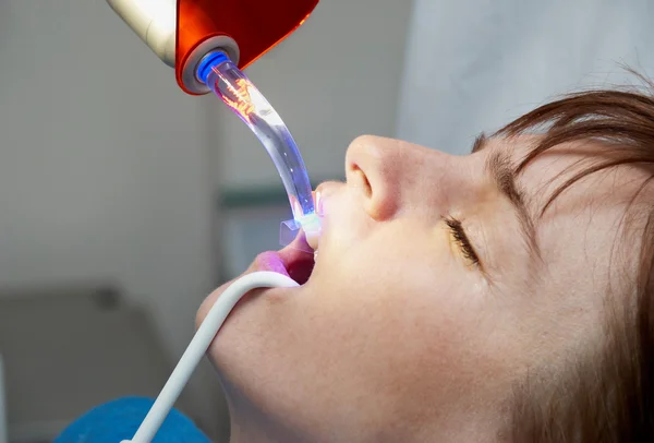 Dentist curing the patient's teeth with ultraviolet lamp — Stock Photo, Image