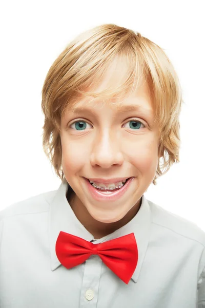 Blonde jongen met tand accolades — Stockfoto